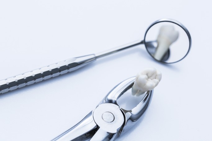 як видаляють зуби